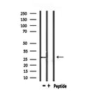 DF6984 at 1/100 staining Mouse liver tissue by IHC-P. The sample was formaldehyde fixed and a heat mediated antigen retrieval step in citrate buffer was performed. The sample was then blocked and incubated with the antibody for 1.5 hours at 22¡ãC. An HRP conjugated goat anti-rabbit antibody was used as the secondary