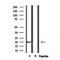 DF6985 at 1/100 staining Mouse muscle tissue by IHC-P. The sample was formaldehyde fixed and a heat mediated antigen retrieval step in citrate buffer was performed. The sample was then blocked and incubated with the antibody for 1.5 hours at 22¡ãC. An HRP conjugated goat anti-rabbit antibody was used as the secondary