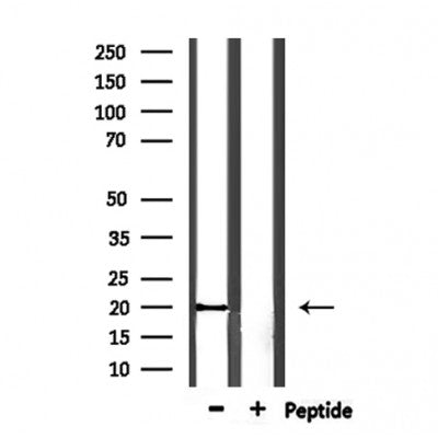 DF6985 at 1/100 staining Mouse muscle tissue by IHC-P. The sample was formaldehyde fixed and a heat mediated antigen retrieval step in citrate buffer was performed. The sample was then blocked and incubated with the antibody for 1.5 hours at 22¡ãC. An HRP conjugated goat anti-rabbit antibody was used as the secondary
