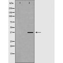 DF6988 at 1/100 staining Mouse brain tissue by IHC-P. The sample was formaldehyde fixed and a heat mediated antigen retrieval step in citrate buffer was performed. The sample was then blocked and incubated with the antibody for 1.5 hours at 22¡ãC. An HRP conjugated goat anti-rabbit antibody was used as the secondary