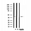 DF6989 at 1/100 staining Human gastric tissue by IHC-P. The sample was formaldehyde fixed and a heat mediated antigen retrieval step in citrate buffer was performed. The sample was then blocked and incubated with the antibody for 1.5 hours at 22¡ãC. An HRP conjugated goat anti-rabbit antibody was used as the secondary