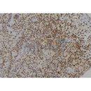 Western blot analysis of extracts from various samples, using PCBP2 Antibody.
 Lane 1: Mouse  brain, treated with blocking peptide;
 Lane 2: Mouse  brain;
 Lane 3: HepG2.