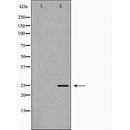 DF6992 at 1/100 staining Mouse kidney tissue by IHC-P. The sample was formaldehyde fixed and a heat mediated antigen retrieval step in citrate buffer was performed. The sample was then blocked and incubated with the antibody for 1.5 hours at 22¡ãC. An HRP conjugated goat anti-rabbit antibody was used as the secondary