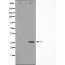 DF6993 at 1/100 staining Human spleen tissue by IHC-P. The sample was formaldehyde fixed and a heat mediated antigen retrieval step in citrate buffer was performed. The sample was then blocked and incubated with the antibody for 1.5 hours at 22¡ãC. An HRP conjugated goat anti-rabbit antibody was used as the secondary