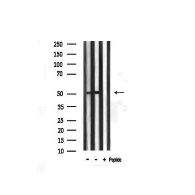 Western blot analysis of Fos expression in various lysates