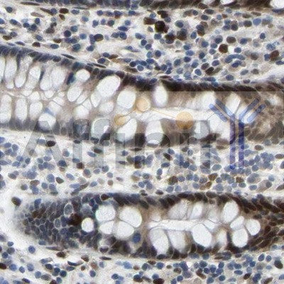 Fos antibody for IHC in human colon testis