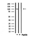 DF7002 at 1/100 staining Mouse liver tissue by IHC-P. The sample was formaldehyde fixed and a heat mediated antigen retrieval step in citrate buffer was performed. The sample was then blocked and incubated with the antibody for 1.5 hours at 22¡ãC. An HRP conjugated goat anti-rabbit antibody was used as the secondary