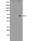 DF7003 at 1/100 staining Human kidney tissue by IHC-P. The sample was formaldehyde fixed and a heat mediated antigen retrieval step in citrate buffer was performed. The sample was then blocked and incubated with the antibody for 1.5 hours at 22¡ãC. An HRP conjugated goat anti-rabbit antibody was used as the secondary