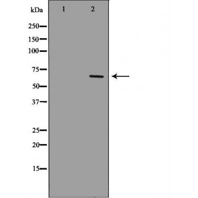 DF7003 at 1/100 staining Human kidney tissue by IHC-P. The sample was formaldehyde fixed and a heat mediated antigen retrieval step in citrate buffer was performed. The sample was then blocked and incubated with the antibody for 1.5 hours at 22¡ãC. An HRP conjugated goat anti-rabbit antibody was used as the secondary