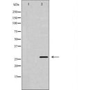 DF7012 at 1/100 staining Human spleen tissue by IHC-P. The sample was formaldehyde fixed and a heat mediated antigen retrieval step in citrate buffer was performed. The sample was then blocked and incubated with the antibody for 1.5 hours at 22¡ãC. An HRP conjugated goat anti-rabbit antibody was used as the secondary