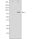 DF7013 at 1/100 staining Human gastric tissue by IHC-P. The sample was formaldehyde fixed and a heat mediated antigen retrieval step in citrate buffer was performed. The sample was then blocked and incubated with the antibody for 1.5 hours at 22¡ãC. An HRP conjugated goat anti-rabbit antibody was used as the secondary