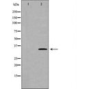 DF7014 at 1/100 staining Mouse liver tissue by IHC-P. The sample was formaldehyde fixed and a heat mediated antigen retrieval step in citrate buffer was performed. The sample was then blocked and incubated with the antibody for 1.5 hours at 22¡ãC. An HRP conjugated goat anti-rabbit antibody was used as the secondary