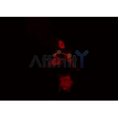 DF7019 staining Hela by IF/ICC. The sample were fixed with PFA and permeabilized in 0.1% Triton X-100,then blocked in 10% serum for 45 minutes at 25¡ãC. The primary antibody was diluted at 1/200 and incubated with the sample for 1 hour at 37¡ãC. An  Alexa Fluor 594 conjugated goat anti-rabbit IgG (H+L) Ab, diluted at 1/600, was used as the secondary antibod