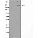 DF7022 at 1/100 staining Mouse muscle tissue by IHC-P. The sample was formaldehyde fixed and a heat mediated antigen retrieval step in citrate buffer was performed. The sample was then blocked and incubated with the antibody for 1.5 hours at 22¡ãC. An HRP conjugated goat anti-rabbit antibody was used as the secondary