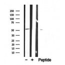 DF7027 at 1/100 staining Human lung tissue by IHC-P. The sample was formaldehyde fixed and a heat mediated antigen retrieval step in citrate buffer was performed. The sample was then blocked and incubated with the antibody for 1.5 hours at 22¡ãC. An HRP conjugated goat anti-rabbit antibody was used as the secondary