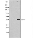 DF7028 at 1/100 staining Mouse pancreas tissue by IHC-P. The sample was formaldehyde fixed and a heat mediated antigen retrieval step in citrate buffer was performed. The sample was then blocked and incubated with the antibody for 1.5 hours at 22¡ãC. An HRP conjugated goat anti-rabbit antibody was used as the secondary
