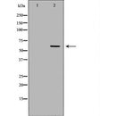 DF7030 at 1/100 staining Human pancreas tissue by IHC-P. The sample was formaldehyde fixed and a heat mediated antigen retrieval step in citrate buffer was performed. The sample was then blocked and incubated with the antibody for 1.5 hours at 22¡ãC. An HRP conjugated goat anti-rabbit antibody was used as the secondary