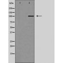 DF7032 at 1/100 staining Human uterus tissue by IHC-P. The sample was formaldehyde fixed and a heat mediated antigen retrieval step in citrate buffer was performed. The sample was then blocked and incubated with the antibody for 1.5 hours at 22¡ãC. An HRP conjugated goat anti-rabbit antibody was used as the secondary