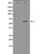 DF7044 at 1/100 staining Mouse liver tissue by IHC-P. The sample was formaldehyde fixed and a heat mediated antigen retrieval step in citrate buffer was performed. The sample was then blocked and incubated with the antibody for 1.5 hours at 22¡ãC. An HRP conjugated goat anti-rabbit antibody was used as the secondary