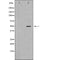 DF7049 staining  Hela cells by IF/ICC. The sample were fixed with PFA and permeabilized in 0.1% Triton X-100,then blocked in 10% serum for 45 minutes at 25¡ãC. The primary antibody was diluted at 1/200 and incubated with the sample for 1 hour at 37¡ãC. An  Alexa Fluor 594 conjugated goat anti-rabbit IgG (H+L) antibody(Cat.