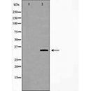 Western blot analysis of extracts of mouse fetal lung tissue lysate, using CA4 antibody. The lane on the left is treated with the antigen-specific peptide.