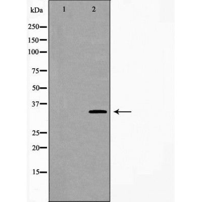 Western blot analysis of extracts of mouse fetal lung tissue lysate, using CA4 antibody. The lane on the left is treated with the antigen-specific peptide.