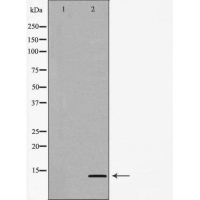 Western blot analysis of extracts of Jurkat , using CCL24 antibody. The lane on the left is treated with the antigen-specific peptide.