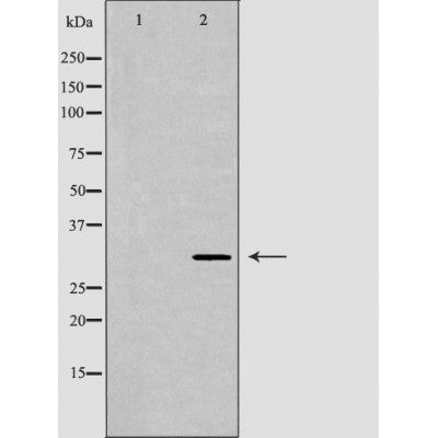 DF7056 staining HepG2 by IF/ICC. The sample were fixed with PFA and permeabilized in 0.1% Triton X-100,then blocked in 10% serum for 45 minutes at 25¡ãC. The primary antibody was diluted at 1/200 and incubated with the sample for 1 hour at 37¡ãC. An  Alexa Fluor 594 conjugated goat anti-rabbit IgG (H+L) Ab, diluted at 1/600, was used as the secondary antibod