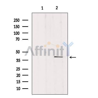 Western blot analysis of extracts from mouse brain, using DLK1 Antibody. Lane 1 was treated with the blocking peptide.