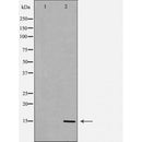 DF7065 at 1/100 staining Human lung tissue by IHC-P. The sample was formaldehyde fixed and a heat mediated antigen retrieval step in citrate buffer was performed. The sample was then blocked and incubated with the antibody for 1.5 hours at 22¡ãC. An HRP conjugated goat anti-rabbit antibody was used as the secondary