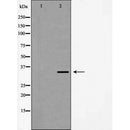 DF7066 staining HepG2 by IF/ICC. The sample were fixed with PFA and permeabilized in 0.1% Triton X-100,then blocked in 10% serum for 45 minutes at 25¡ãC. The primary antibody was diluted at 1/200 and incubated with the sample for 1 hour at 37¡ãC. An  Alexa Fluor 594 conjugated goat anti-rabbit IgG (H+L) Ab, diluted at 1/600, was used as the secondary antibod