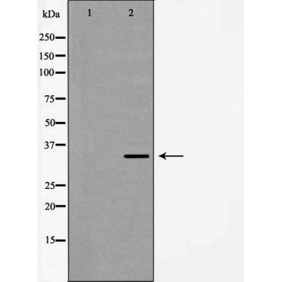DF7066 staining HepG2 by IF/ICC. The sample were fixed with PFA and permeabilized in 0.1% Triton X-100,then blocked in 10% serum for 45 minutes at 25¡ãC. The primary antibody was diluted at 1/200 and incubated with the sample for 1 hour at 37¡ãC. An  Alexa Fluor 594 conjugated goat anti-rabbit IgG (H+L) Ab, diluted at 1/600, was used as the secondary antibod