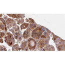 Western blot analysis of extracts from Mouse brain, using GNA11 Antibody. Lane 1 was treated with the blocking peptide.