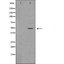 Western blot analysis of extracts of mouse brains, using GNAS antibody. The lane on the left is treated with the antigen-specific peptide.