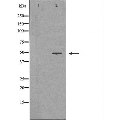 Western blot analysis of extracts of mouse brains, using GNAS antibody. The lane on the left is treated with the antigen-specific peptide.