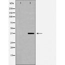 DF7070 at 1/100 staining Human melanoma tissue by IHC-P. The sample was formaldehyde fixed and a heat mediated antigen retrieval step in citrate buffer was performed. The sample was then blocked and incubated with the antibody for 1.5 hours at 22¡ãC. An HRP conjugated goat anti-rabbit antibody was used as the secondary