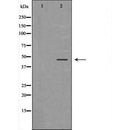 DF7076 at 1/100 staining Human breast cancer tissue by IHC-P. The sample was formaldehyde fixed and a heat mediated antigen retrieval step in citrate buffer was performed. The sample was then blocked and incubated with the antibody for 1.5 hours at 22¡ãC. An HRP conjugated goat anti-rabbit antibody was used as the secondary
