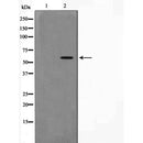 DF7078 at 1/100 staining Human prostate tissue by IHC-P. The sample was formaldehyde fixed and a heat mediated antigen retrieval step in citrate buffer was performed. The sample was then blocked and incubated with the antibody for 1.5 hours at 22¡ãC. An HRP conjugated goat anti-rabbit antibody was used as the secondary