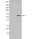 DF7082 at 1/100 staining Mouse liver tissue by IHC-P. The sample was formaldehyde fixed and a heat mediated antigen retrieval step in citrate buffer was performed. The sample was then blocked and incubated with the antibody for 1.5 hours at 22¡ãC. An HRP conjugated goat anti-rabbit antibody was used as the secondary