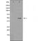 DF7093 staining A549 by IF/ICC. The sample were fixed with PFA and permeabilized in 0.1% Triton X-100,then blocked in 10% serum for 45 minutes at 25¡ãC. The primary antibody was diluted at 1/200 and incubated with the sample for 1 hour at 37¡ãC. An  Alexa Fluor 594 conjugated goat anti-rabbit IgG (H+L) Ab, diluted at 1/600, was used as the secondary antibod
