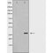 Western blot analysis of extracts of mouse eyes tissue lysate, using AQP0 antibody. The lane on the left is treated with the antigen-specific peptide.