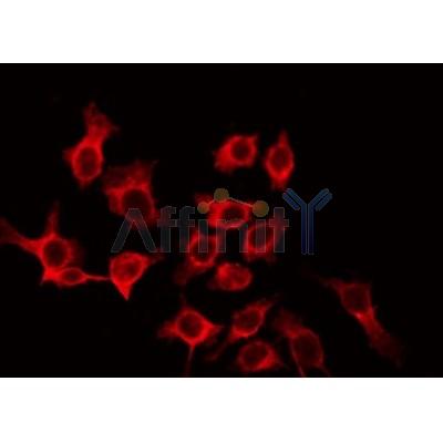 AF0133 staining LOVO by IF/ICC. The sample were fixed with PFA and permeabilized in 0.1% Triton X-100,then blocked in 10% serum for 45 minutes at 25¡ãC. The primary antibody was diluted at 1/200 and incubated with the sample for 1 hour at 37¡ãC. An  Alexa Fluor 594 conjugated goat anti-rabbit IgG (H+L) Ab, diluted at 1/600, was used as the secondary antibod