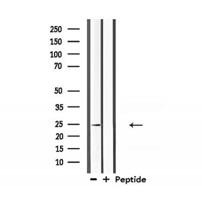 Western blot analysis of extracts from 293, using Claudin 10 Antibody.