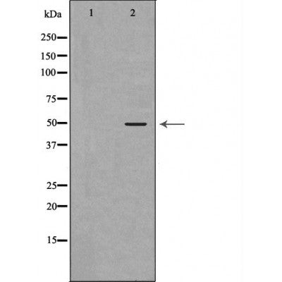 Western blot analysis of extracts of NCL-H460 , using EDA antibody. The lane on the left is treated with the antigen-specific peptide.