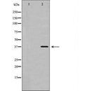 DF7111 staining HepG2 by IF/ICC. The sample were fixed with PFA and permeabilized in 0.1% Triton X-100,then blocked in 10% serum for 45 minutes at 25¡ãC. The primary antibody was diluted at 1/200 and incubated with the sample for 1 hour at 37¡ãC. An  Alexa Fluor 594 conjugated goat anti-rabbit IgG (H+L) Ab, diluted at 1/600, was used as the secondary antibod