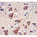 DF7117 staining HepG2 by IF/ICC. The sample were fixed with PFA and permeabilized in 0.1% Triton X-100,then blocked in 10% serum for 45 minutes at 25¡ãC. The primary antibody was diluted at 1/200 and incubated with the sample for 1 hour at 37¡ãC. An  Alexa Fluor 594 conjugated goat anti-rabbit IgG (H+L) Ab, diluted at 1/600, was used as the secondary antibod