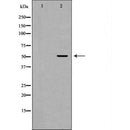 DF7118 at 1/100 staining Human liver cancer tissue by IHC-P. The sample was formaldehyde fixed and a heat mediated antigen retrieval step in citrate buffer was performed. The sample was then blocked and incubated with the antibody for 1.5 hours at 22¡ãC. An HRP conjugated goat anti-rabbit antibody was used as the secondary