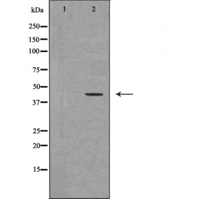 Western blot analysis of extracts of Mouse fetalmuscle tissue lysate, using UTS2R antibody. The lane on the left is treated with the antigen-specific peptide.