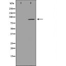 Western blot analysis of extracts of Mouse brain tissue lysate, using KCNH2antibody. The lane on the left is treated with the antigen-specific peptide.