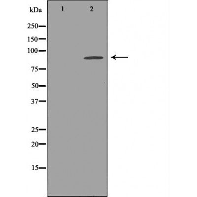 Western blot analysis of extracts of Mouse brain tissue lysate, using KCNH2antibody. The lane on the left is treated with the antigen-specific peptide.